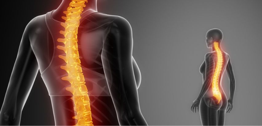 Kyphosis muscles to online strengthen